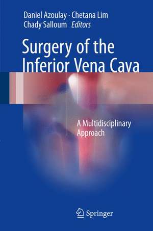 Surgery of the Inferior Vena Cava: A Multidisciplinary Approach de Daniel Azoulay