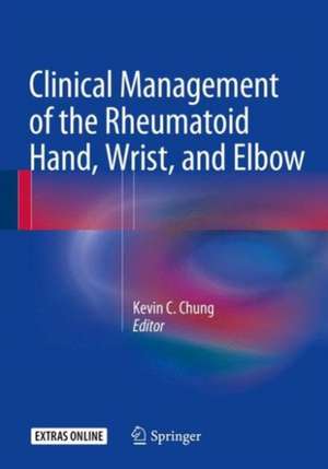 Clinical Management of the Rheumatoid Hand, Wrist, and Elbow de Kevin C. Chung