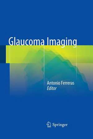 Glaucoma Imaging de Antonio Ferreras