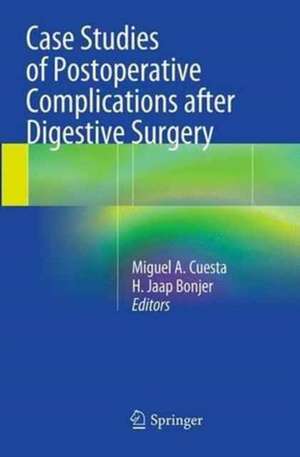 Case Studies of Postoperative Complications after Digestive Surgery de Miguel A. Cuesta