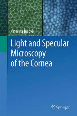 Light and Specular Microscopy of the Cornea de Katerina Jirsova