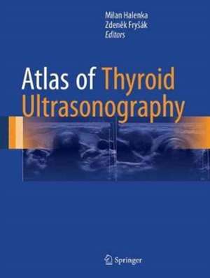 Atlas of Thyroid Ultrasonography de Milan Halenka