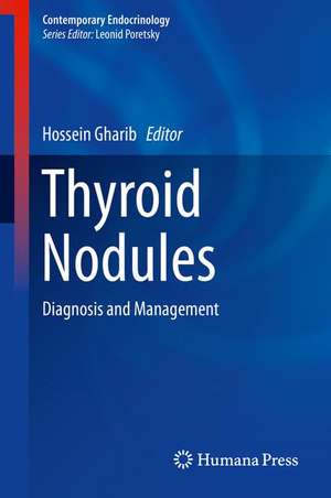 Thyroid Nodules: Diagnosis and Management de Hossein Gharib