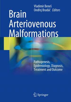 Brain Arteriovenous Malformations: Pathogenesis, Epidemiology, Diagnosis, Treatment and Outcome de Vladimír Beneš