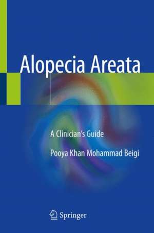 Alopecia Areata: A Clinician's Guide de Pooya Khan Mohammad Beigi