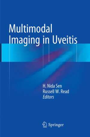 Multimodal Imaging in Uveitis de H. Nida Sen