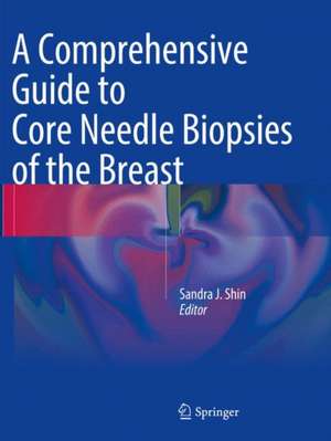 A Comprehensive Guide to Core Needle Biopsies of the Breast de Sandra J. Shin