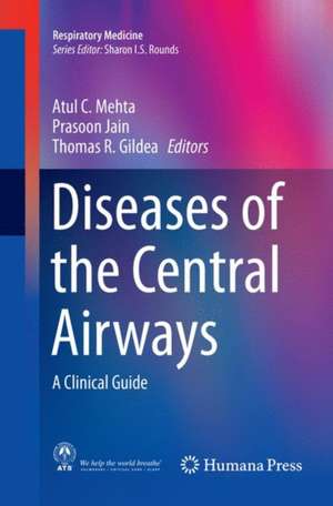 Diseases of the Central Airways: A Clinical Guide de Atul C. Mehta