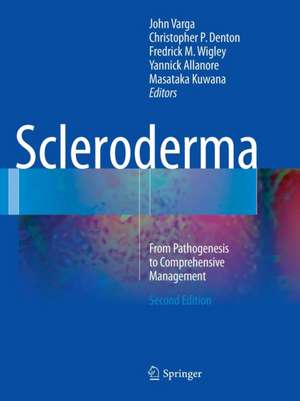 Scleroderma: From Pathogenesis to Comprehensive Management de John Varga