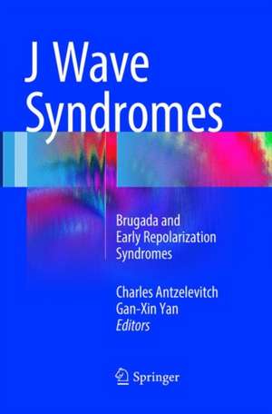 J Wave Syndromes: Brugada and Early Repolarization Syndromes de Charles Antzelevitch