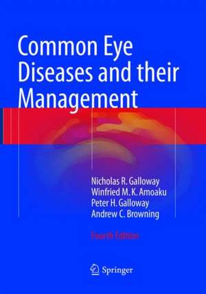 Common Eye Diseases and their Management de Nicholas R. Galloway