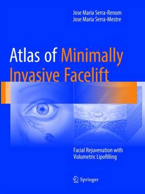 Atlas of Minimally Invasive Facelift: Facial Rejuvenation with Volumetric Lipofilling de Jose Maria Serra-Renom