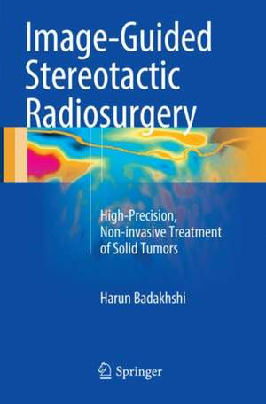 Image-Guided Stereotactic Radiosurgery: High-Precision, Non-invasive Treatment of Solid Tumors de Harun Badakhshi