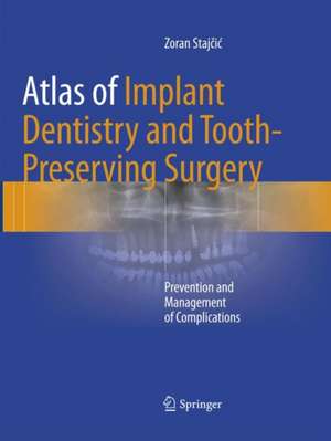 Atlas of Implant Dentistry and Tooth-Preserving Surgery: Prevention and Management of Complications de Zoran Stajčić