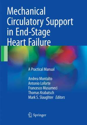 Mechanical Circulatory Support in End-Stage Heart Failure: A Practical Manual de Andrea Montalto