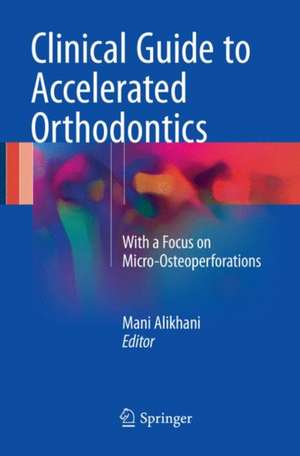 Clinical Guide to Accelerated Orthodontics: With a Focus on Micro-Osteoperforations de Mani Alikhani