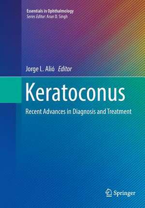 Keratoconus: Recent Advances in Diagnosis and Treatment de Jorge L. Alió