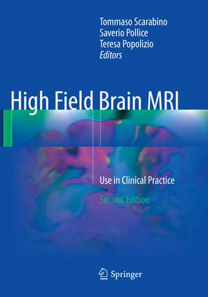 High Field Brain MRI de Saverio Pollice