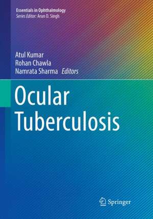 Ocular Tuberculosis de Atul Kumar