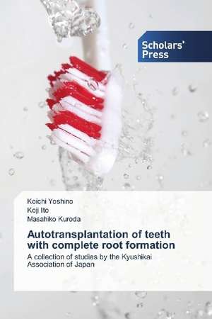 Autotransplantation of teeth with complete root formation de Koichi Yoshino