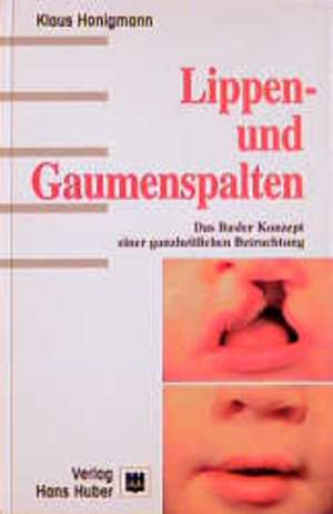 Lippen- und Gaumenspalten de Klaus Honigmann