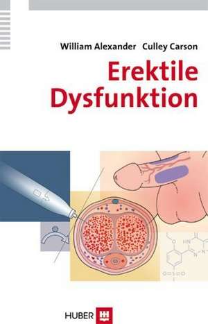 Erektile Dysfunktion de William Alexander