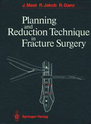 Planning and Reduction Technique in Fracture Surgery de H. Willenegger