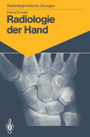 Radiologie der Hand: 147 diagnostische Übungen für Studenten und praktische Radiologen de Pierre Bourjat