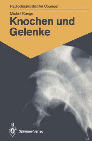 Knochen und Gelenke: 170 diagnostische Übungen für Studenten und praktische Radiologen de Michel Runge