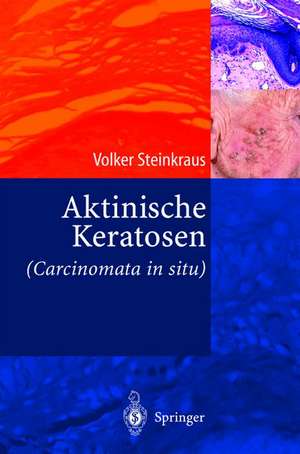 Aktinische Keratosen (Carcinomata in situ) de Volker Steinkraus