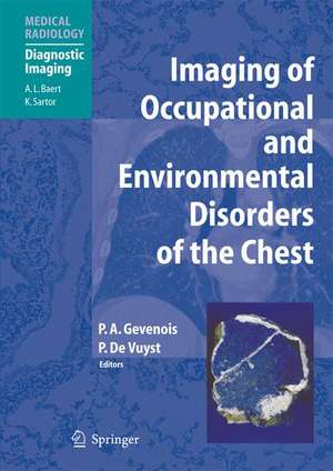 Imaging of Occupational and Environmental Disorders of the Chest de Pierre Alain Gevenois