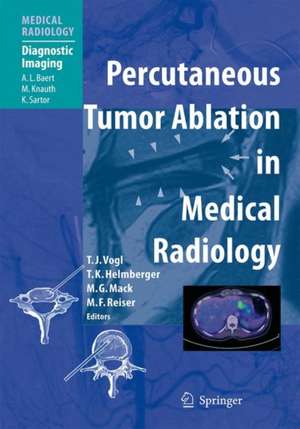 Percutaneous Tumor Ablation in Medical Radiology de Thomas J. Vogl