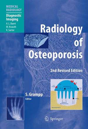 Radiology of Osteoporosis de Stephan Grampp