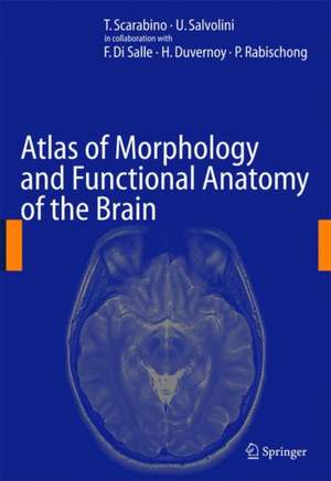 Atlas of Morphology and Functional Anatomy of the Brain de T. Scarabino