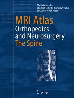 MRI Atlas: Orthopedics and Neurosurgery, The Spine de Martin Weyreuther
