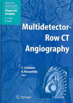 Multidetector-Row CT Angiography de A.L. Baert