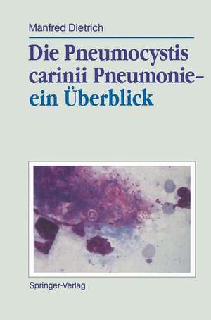 Die Pneumocystis carinii Pneumonie— ein Überblick de Manfred Dietrich