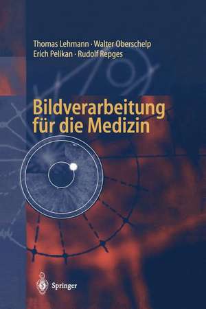 Bildverarbeitung für die Medizin: Grundlagen, Modelle, Methoden, Anwendungen de Thomas Lehmann