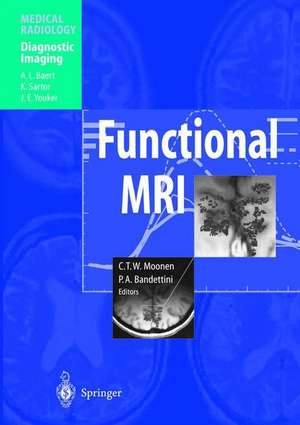 Functional MRI de Moonen, C. T.