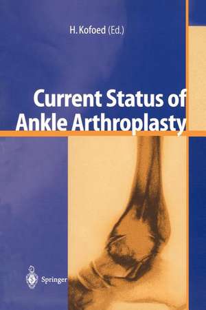 Current Status of Ankle Arthroplasty de Hakon Kofoed