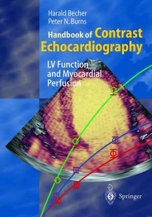 Handbook of Contrast Echocardiography: Left ventricular function and myocardial perfusion de Harald Becher