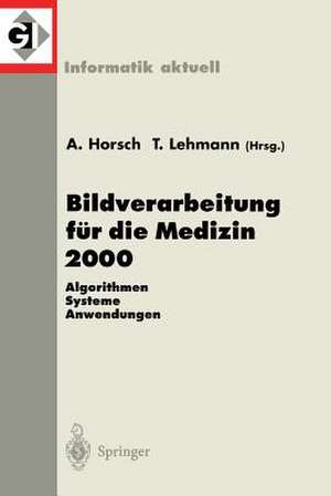 Bildverarbeitung für die Medizin 2000: Algorithmen - Systeme - Anwendungen de Alexander Horsch