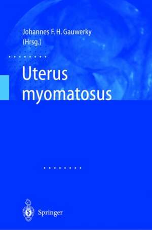 Uterus Myomatosus