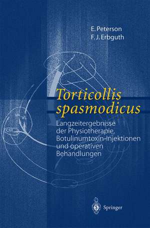 Torticollis spasmodicus: Langzeitergebnisse der Physiotherapie, Botulinumtoxin-Injektionen und operativen Behandlungen de E. Peterson