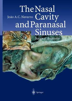 The Nasal Cavity and Paranasal Sinuses: Surgical Anatomy de Joao A.C. Navarro