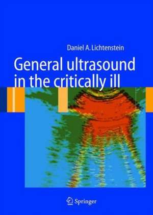 General ultrasound in the critically ill de Daniel A. Lichtenstein