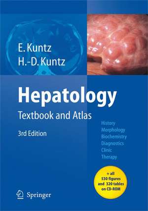 Hepatology: Textbook and Atlas de Erwin Kuntz