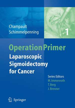 Laparoscopic Sigmoidectomy for Cancer de A.-K. Güler