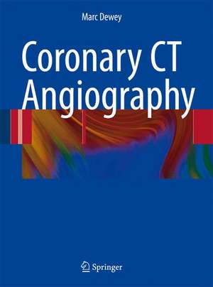 Coronary CT Angiography de Marc Dewey