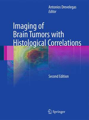 Imaging of Brain Tumors with Histological Correlations de Antonios Drevelegas